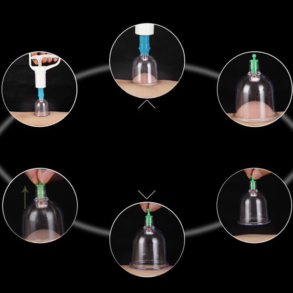 24 Vacuüm Cupping Cups Kit Thu - Home Improvement Kit recensie en prijs